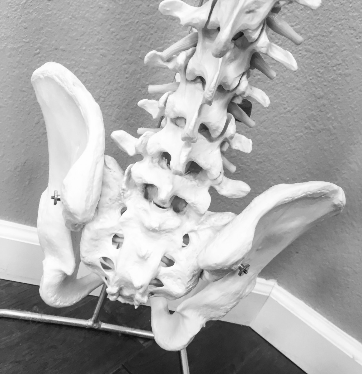 dr-lynelle-mcsweeney-reno-chiropractic-postural-analysis