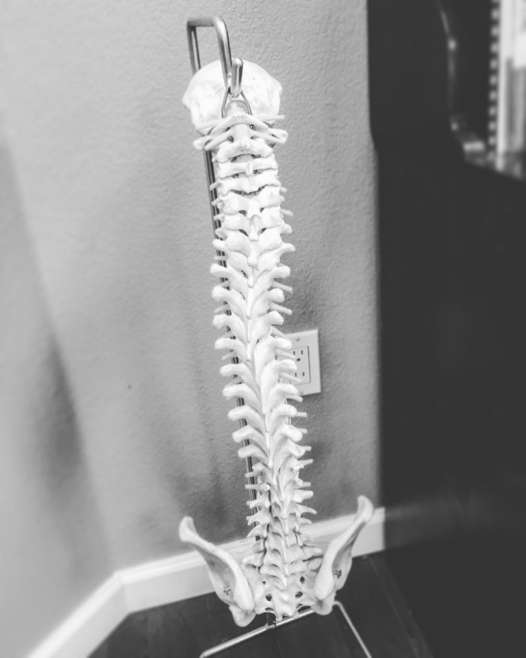 dr-lynelle-mcsweeney-reno-chiropractor-spinal-misalignment